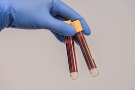 Grave malattia sangue legata a invecchiamento, chiarite le cause (fonte: Pixabay)