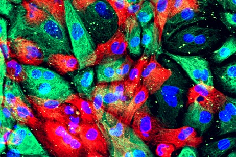 Cellule di un organoide di tumore della prostata (fonte: National Cancer Institute, National Institutes of Health da Flickr CC BY-NC 2.0)