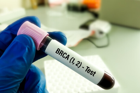 Tumore al seno e mutazione Brca, togliere ovaie riduce mortalità. (Fonte: Md Saiful Islam Khan da iStock)