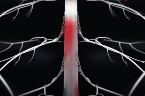 Rappresentazione grafica della stimolazione spinale (fonte: EPFL)