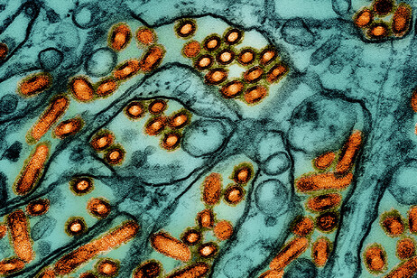 Il virus H5N1 responsaile dell'influenza aviaria (fonte: CDC e NIAID da Flickr CC BY 2.0)