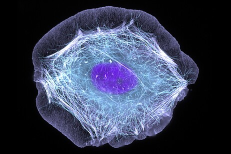 Cellula della pelle (fonte: ZEISS Microscopy da Flickr, foto di Torsten Wittmann, University of California, San Francisco CC BY-NC-ND 2.0)
