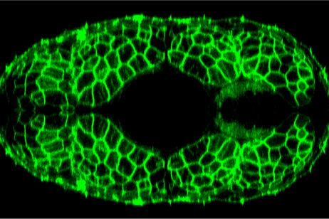 Cellule dei muscoli del pesce zebra, rese fluorescenti (fonte:&nbsp;King's College London)