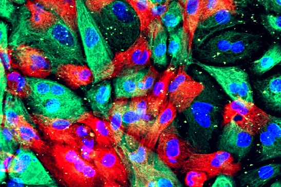 Cellule di un organoide di tumore della prostata (fonte: National Cancer Institute, National Institutes of Health da Flickr CC BY-NC 2.0)