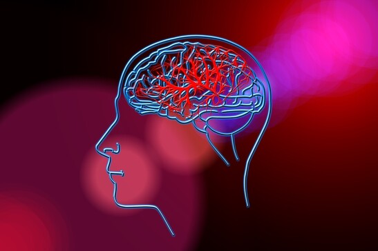 L' emorragia cerebrale terzo killer dopo infarto e tumori (fonte: Needpix)