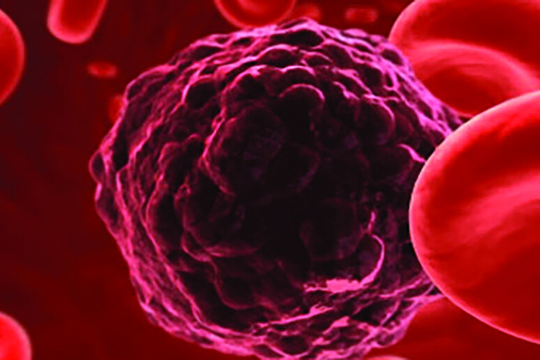 La biopsia liquida che cerca le tracce dei tumori nel sangue diventa più precisa (fonte: ESMO) - RIPRODUZIONE RISERVATA