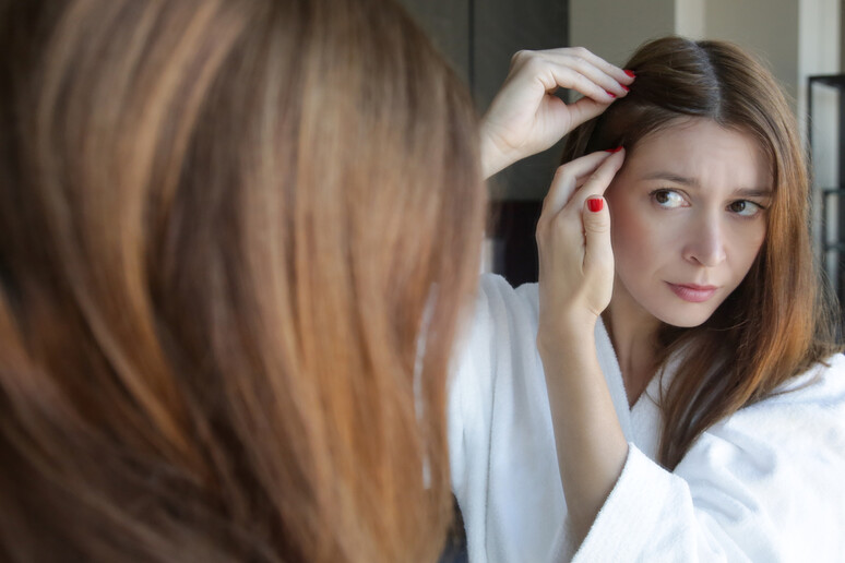 Alopecia, arriva la prima terapia orale per adulti e adolescenti - RIPRODUZIONE RISERVATA